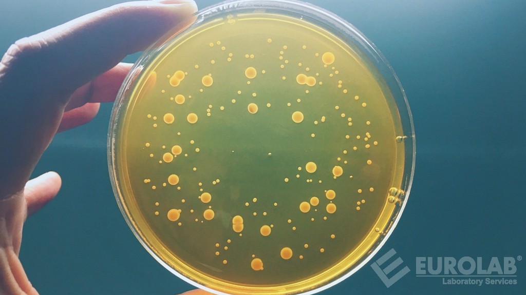 Liczba kolonii tlenowych (liczba bakterii tlenowych)