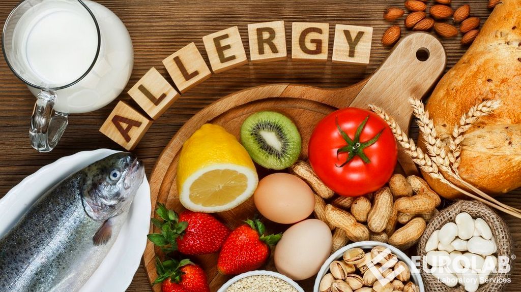 Alerjen Değildir Testleri