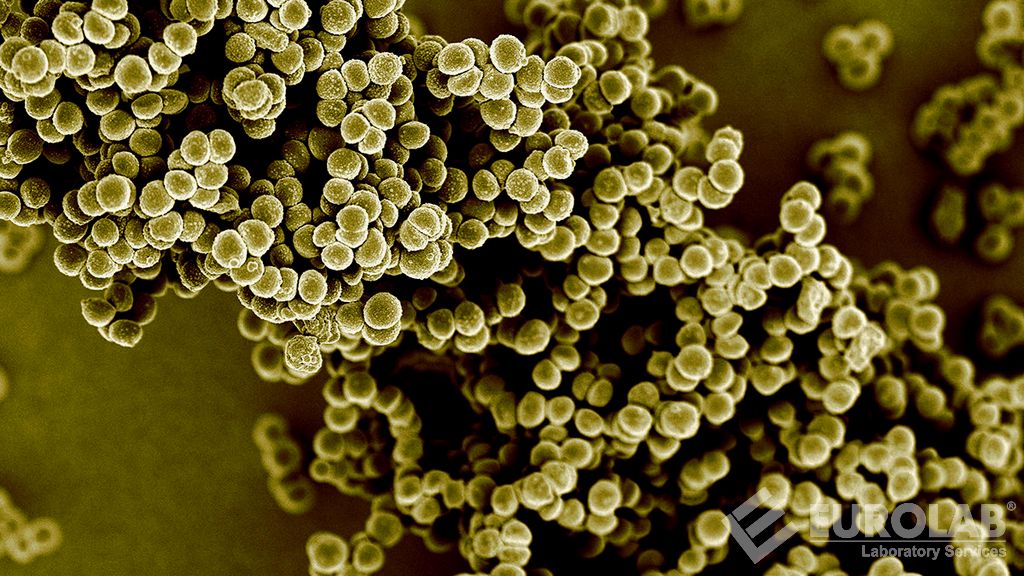 AOAC 991.48 Testování dezinfekčních prostředků proti Staphylococcus Aureus, testovací metoda nosičů s tvrdým povrchem