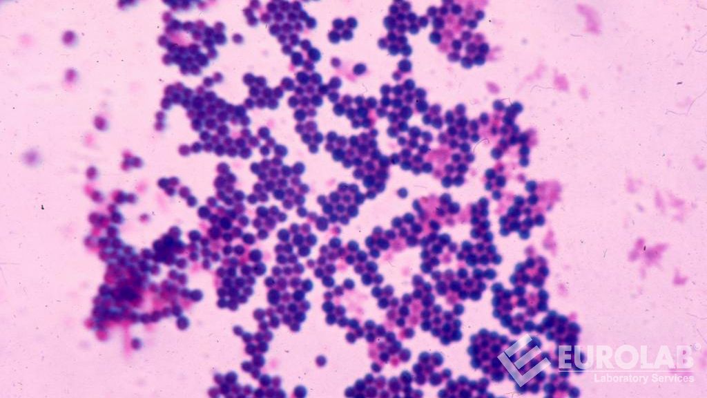 Staphylococcal Enterotoxins by AOAC 993.06 Enzyme Immunoassay Staphylococcal Enterotoxins by AOAC 993.06 Enzyme Immunoassay