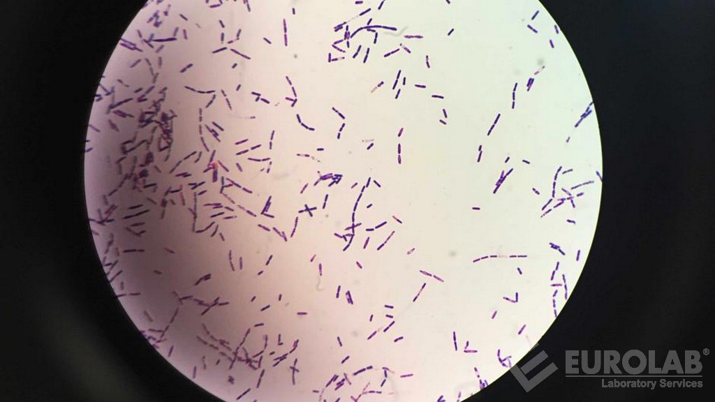 Bacillus Cereus Sayımı
