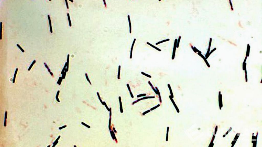 À la recherche de Clostridium Perfringens