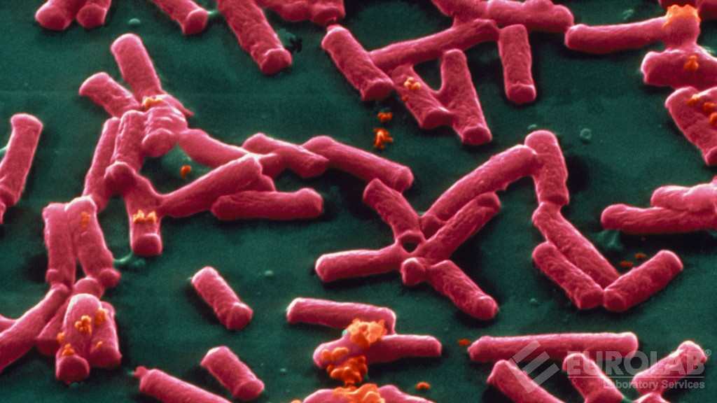 Clostridium Perfringens Count