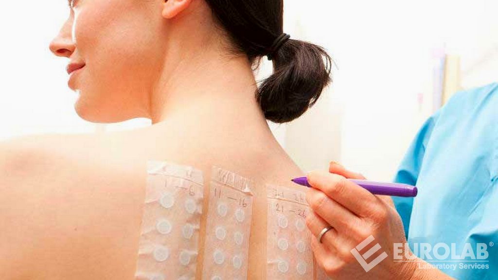 Tests cliniques dermatologiques