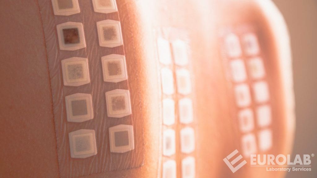 Dermatolojik Yama Testi