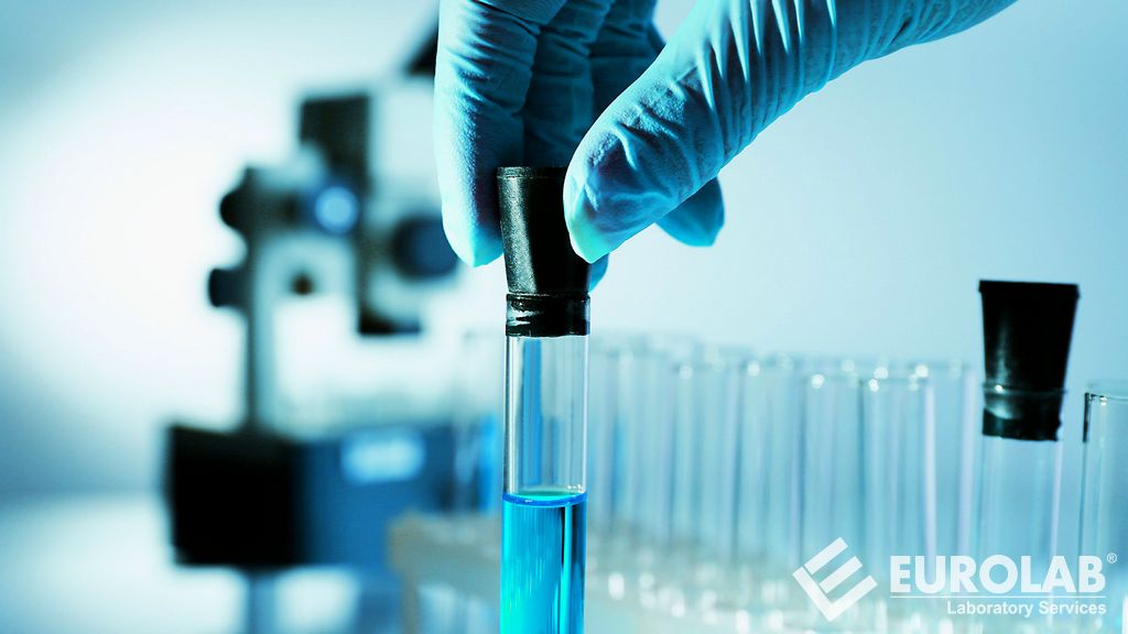 Dimethylsulfoxide (DMSO) analyse