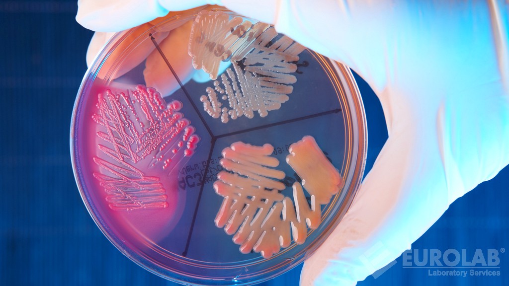 Conte delle enterobatteri Conte delle enterobatteri