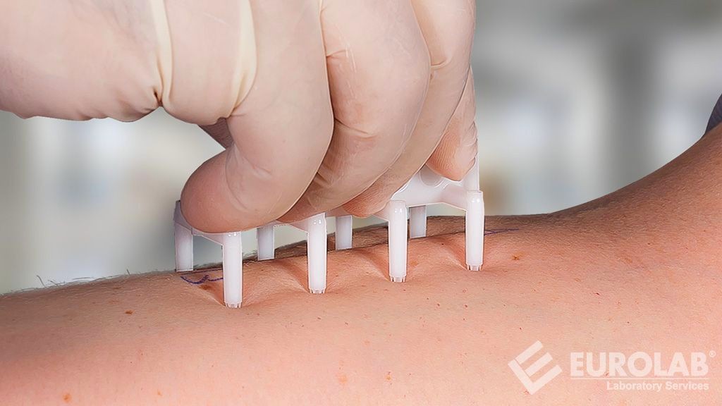 EPI-200-SCT Cilt Korozyon Testi