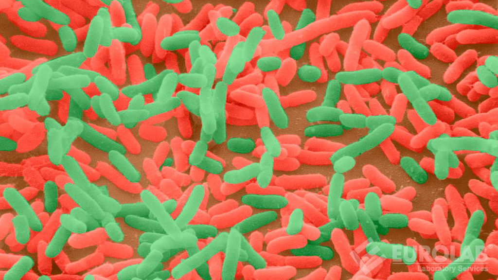 Escherichia Coli et nombre de bactéries coliformes (TS EN ISO 9308-1)