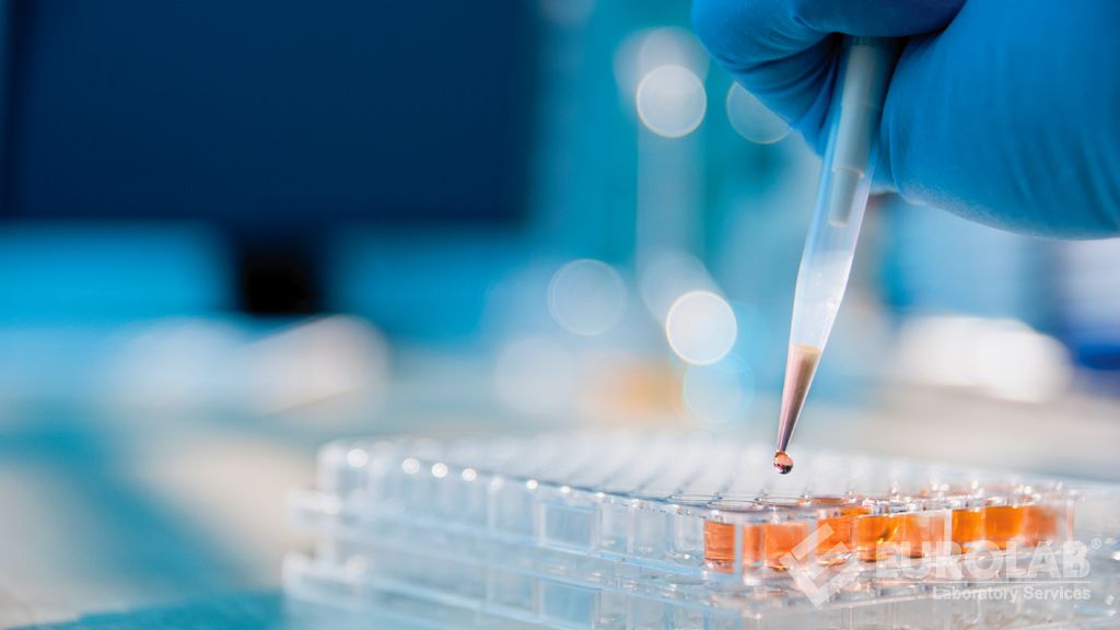 İlaç Alerji Testleri