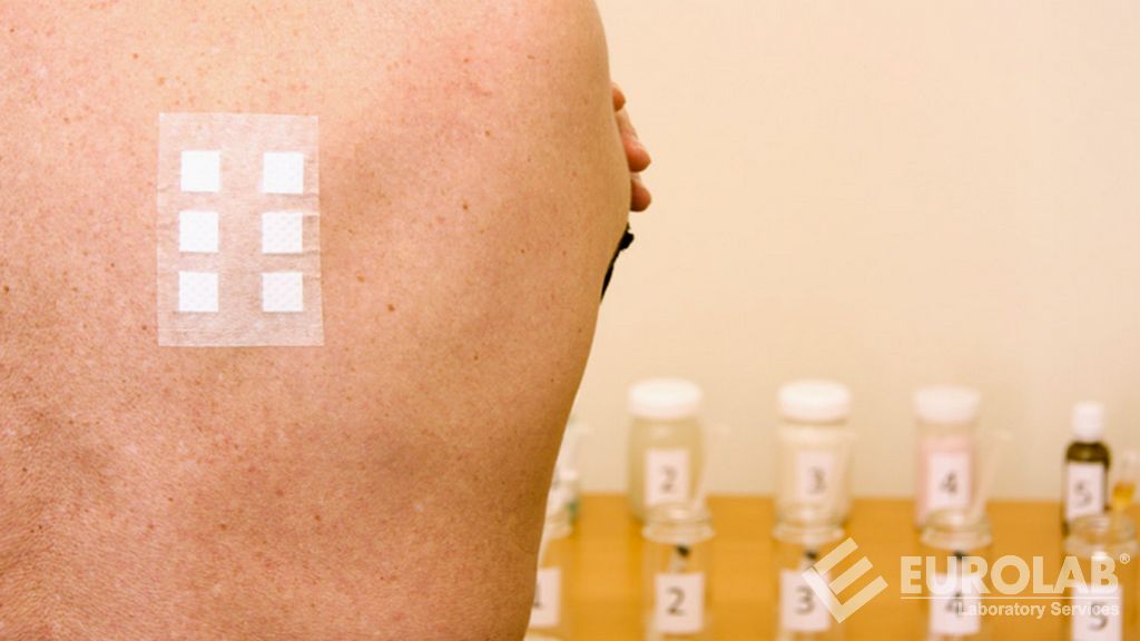 In Vivo Human Repeated Damage Patch Test (HRIPT)