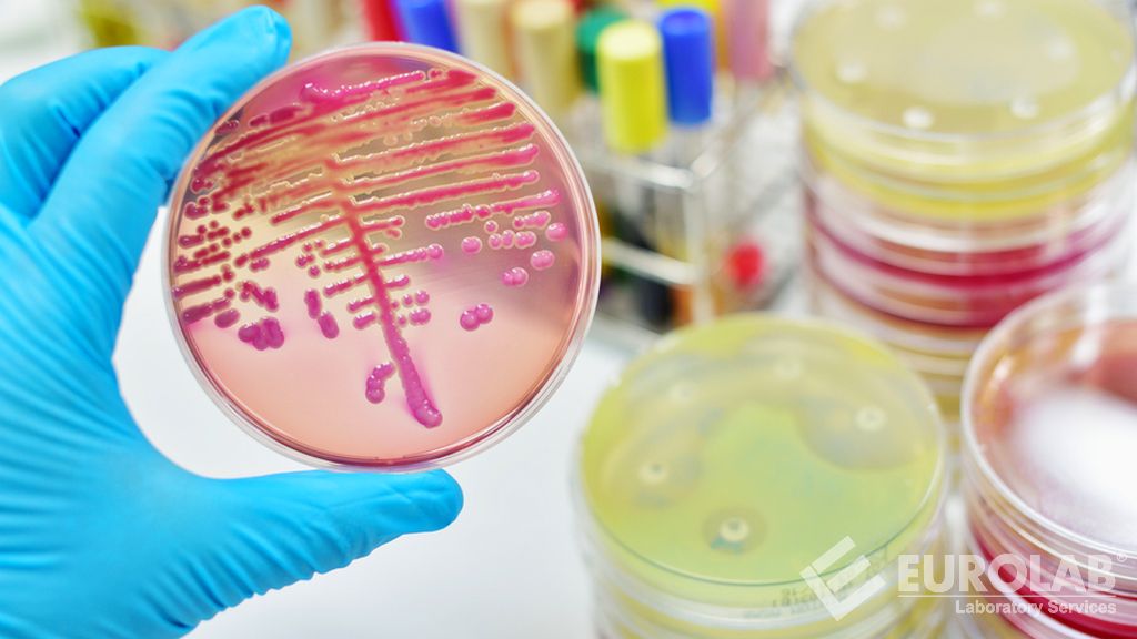 ISO 16649-2 Gıda ve Hayvan Yemlerinin Mikrobiyolojisi - Beta-Glukuronidaz Pozitif Escherichia Coli Sayımı İçin Yatay Yöntem - Bölüm 2: 5-Bromo-4-Kloro-3-İndolil Beta-D-Glukuronid Kullanılarak 44 Derecede Koloni Sayımı Tekniği