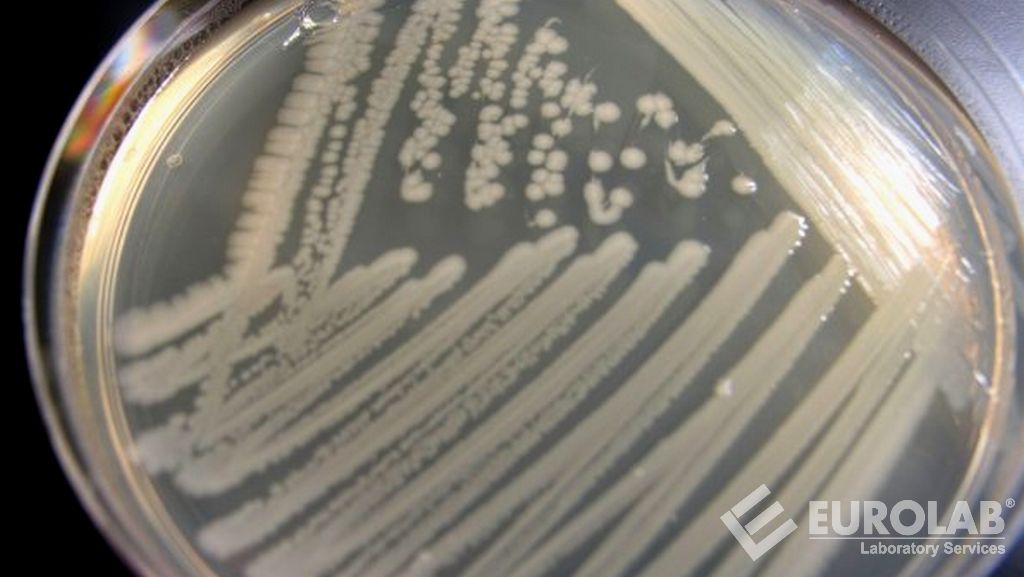 ISO 16654 Microbiologie de l'alimentation humaine et animale - Méthode horizontale pour la détection d'Escherichia Coli O157