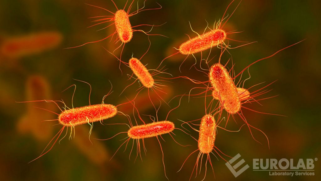 ISO 21150 Kozmetikler - Mikrobiyoloji - Escherichia Coli Aranması