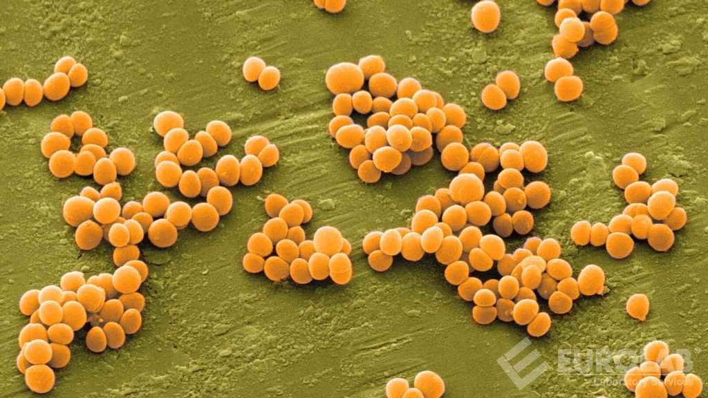 ISO 22718 Kozmetikler - Mikrobiyoloji - Staphylococcus Aureus Aranması