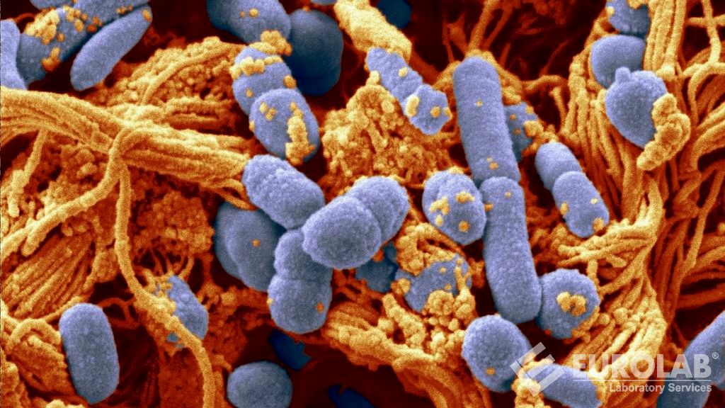 ISO 6579 Microbiologie de l'alimentation humaine et animale - Méthode horizontale pour la détection de Salmonella Spp.