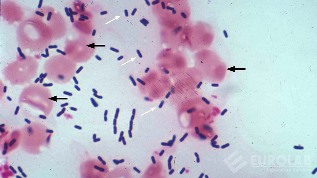 Listeria spp. Badawczy