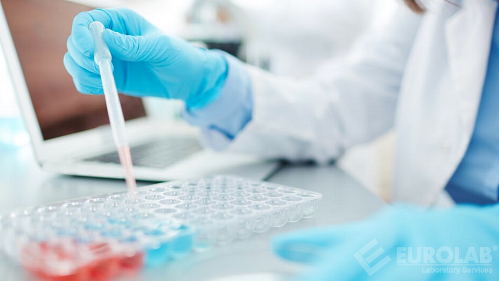 Metod Validasyonu ve Transfer