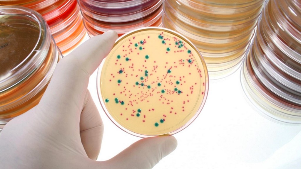 Mikrobiyal Tanımlama Testleri