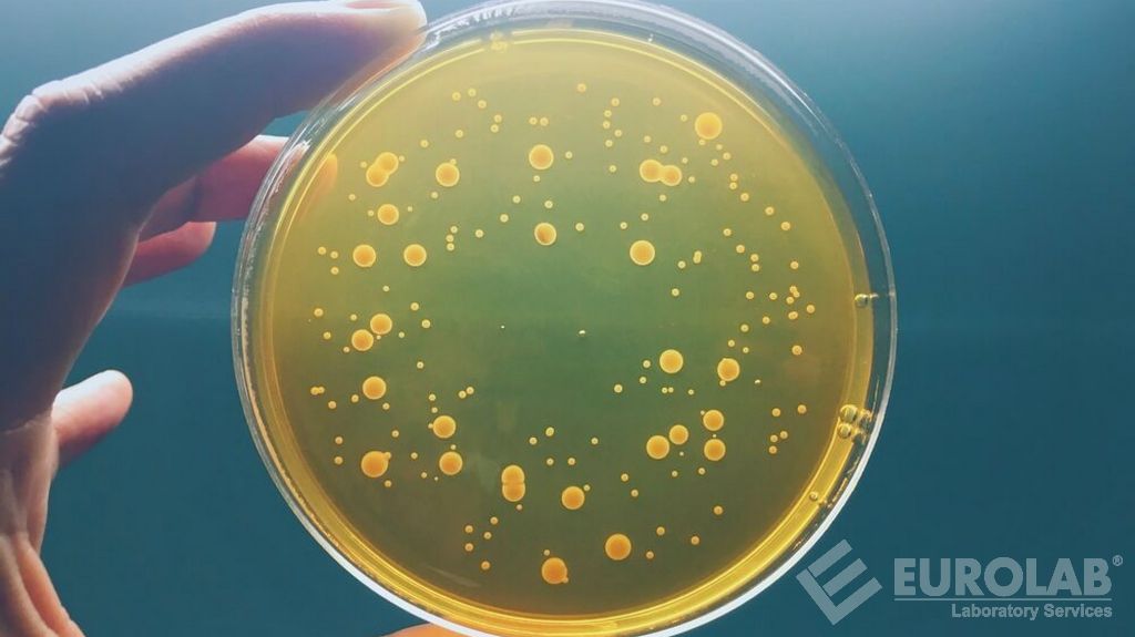 Tests microbiologiques - Dénombrement des colonies aérobies (numération des bactéries aérobies)