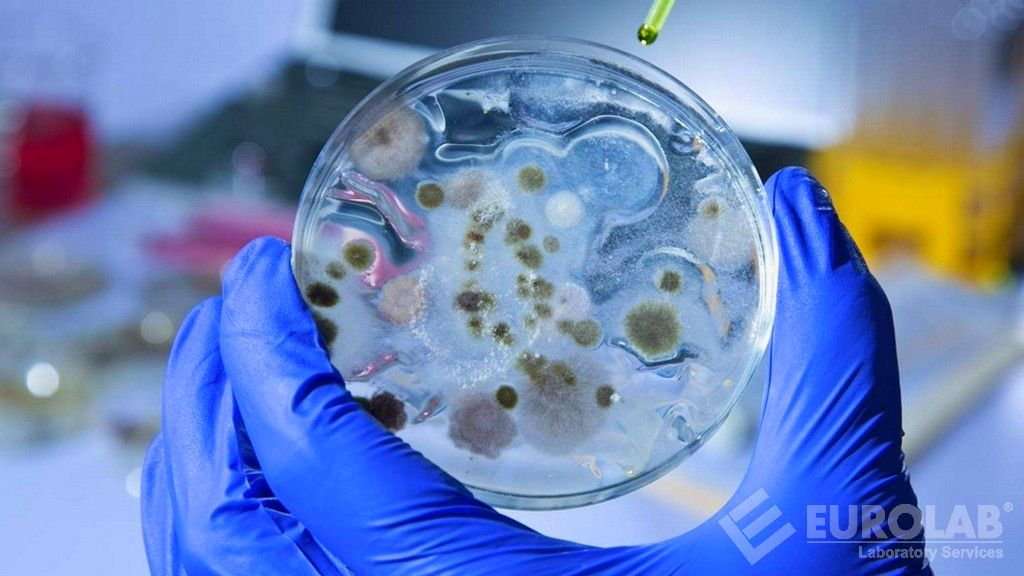 Tests microbiologiques - Dénombrement des bactéries anaérobies