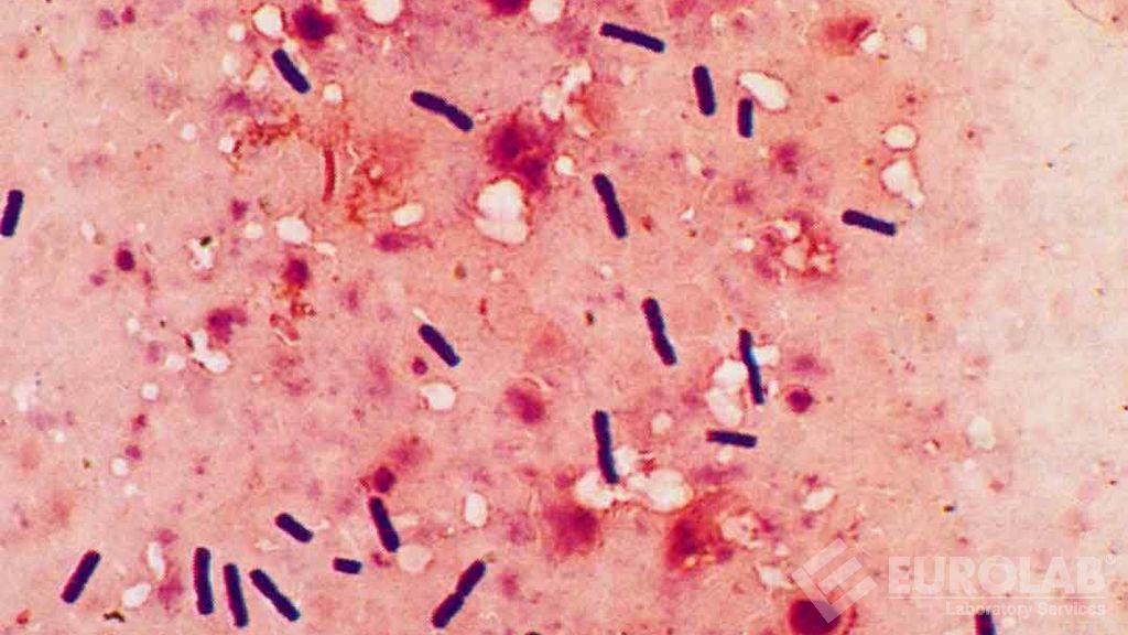 Tests microbiologiques - Dénombrement de Clostridium Perfringens