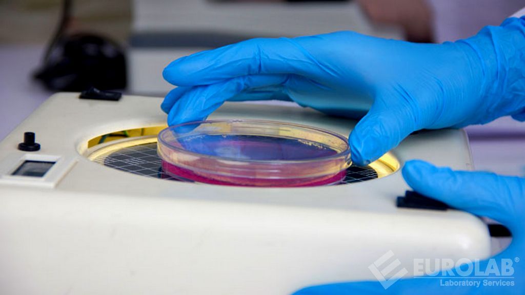 Microbiological Tests - Escherchia Coli Count Microbiological Tests - Escherchia Coli Count