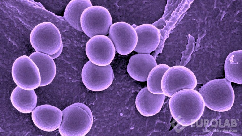 Tests microbiologiques - Dénombrement des staphylocoques positifs à la coagulase (Staphylococcus aureus)