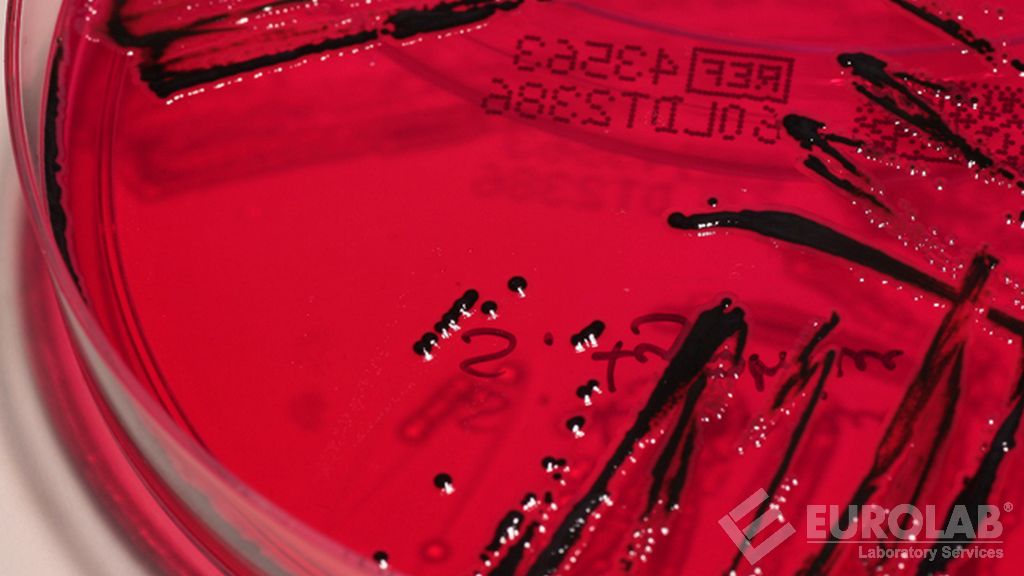 Mikrobiyolojik Testler - Listeria spp Aranması