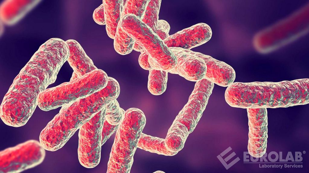 Tests de Pseudomonas Aeruginosa (ATCC 9027)