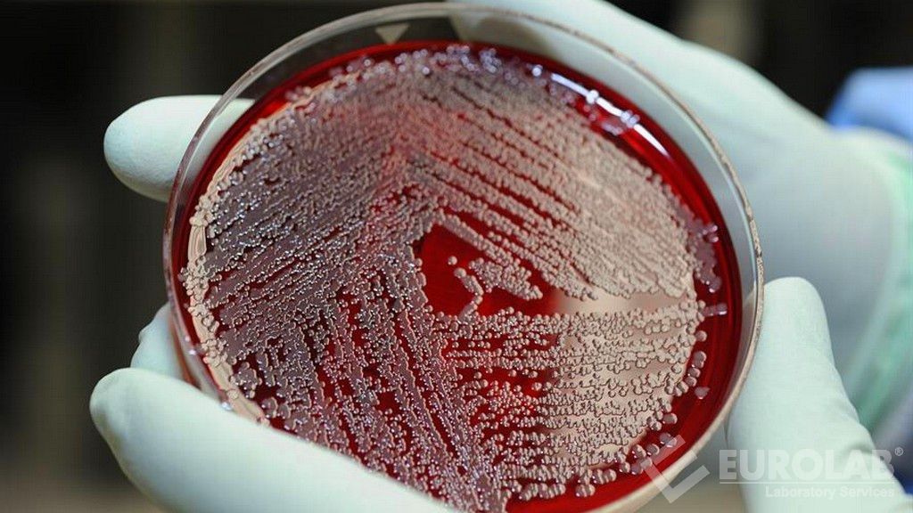 Recensement de Pseudomonas Aeruginosa (ISO 16266)