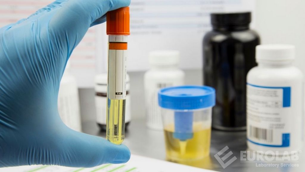 Reçine Asidinin Belirlenmesi