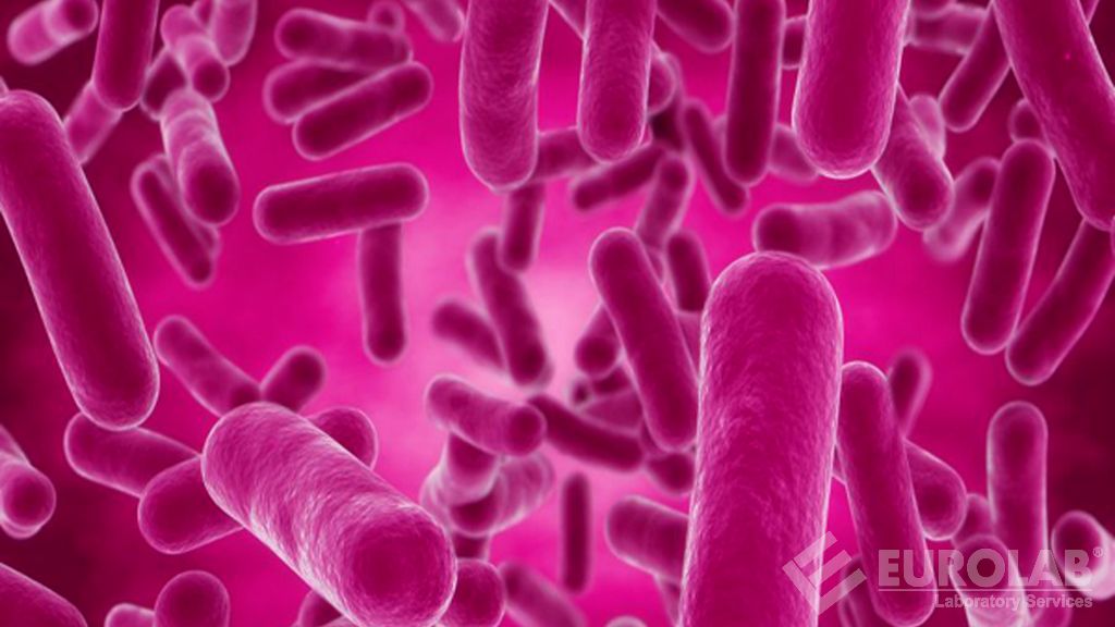 Salmonella spp. Détection (TS EN ISO 19250)