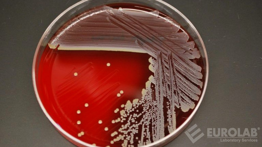 ブドウ球菌エンテロトキシン検索ELISA法