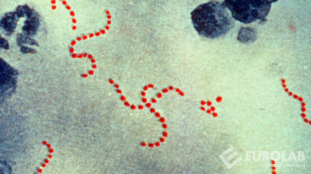 Streptococcus Pyogenes Tayini