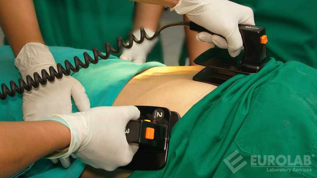 TS EN 60601-2-4 Elektrikli Tıbbi Donanım - Bölüm 2-4: Kalp Defibrilatörlerinin Temel Güvenliği ve Önemli Performansı İçin Belirli Özellikler
