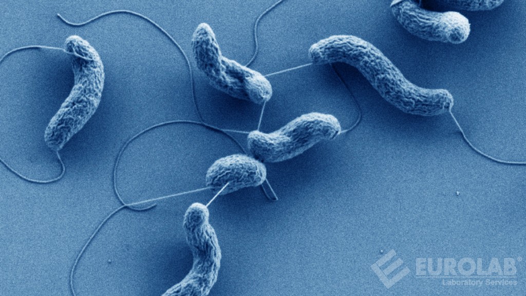 Recherche de Vibrio spp Vibrio parahaemolyticus et Vibrio cholerae
