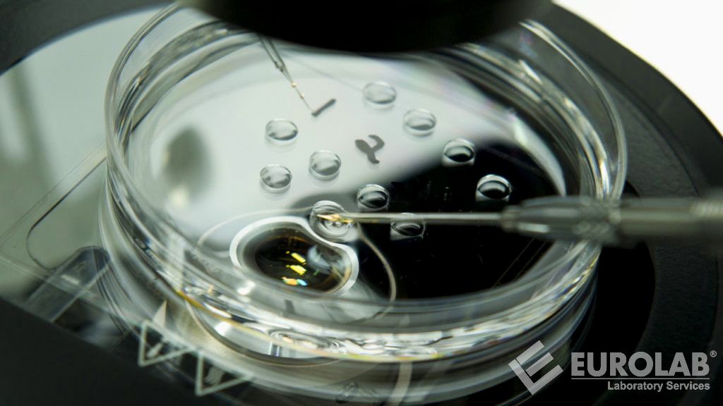 Test di migrazione della superficie